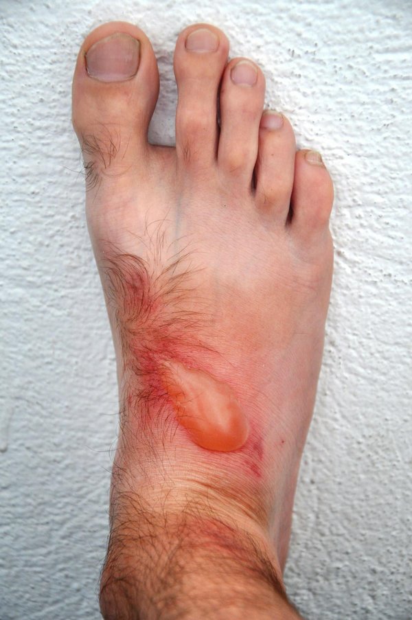 ¿Cómo reconocer y tratar la dermatitis en gatos?
